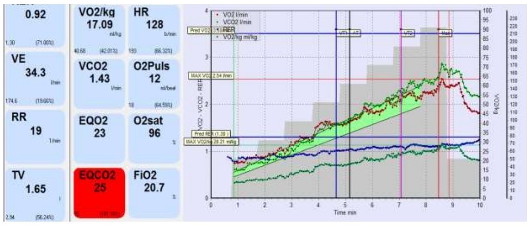 پرتکل افزاینده تست ورزش قلبی ریوی همراه با تعيين ). (VO2 از VCO2 و استانه بیهوازی زمانی کهVCO2 ، VO2max   بیشتر می شود ) این بیمار به مقدار مورد انتظار نمی رسد(