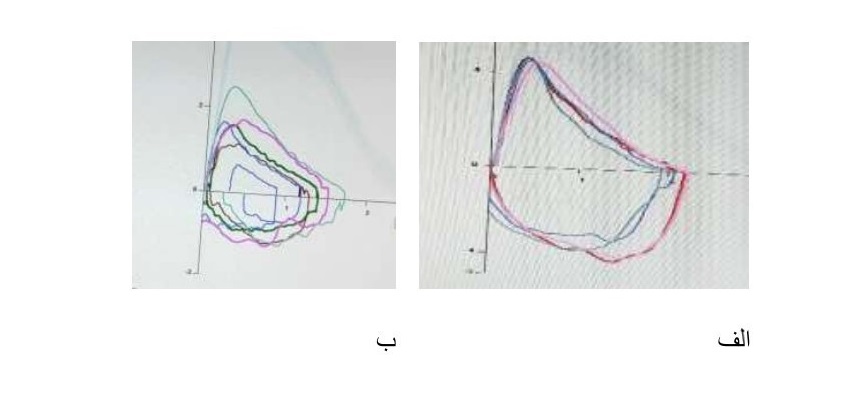 تعيين همکاری خوب در اسپیرومتری براساس معیار تطابق (Consistency)= الف- همکاری خوب به تطابق شدید در مانور وسطی دقت کنید ب- تطابق بد- به عدم تطابق همه مانورها دقت کنید.